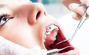 aparelho-ortodôntico-w.-dental