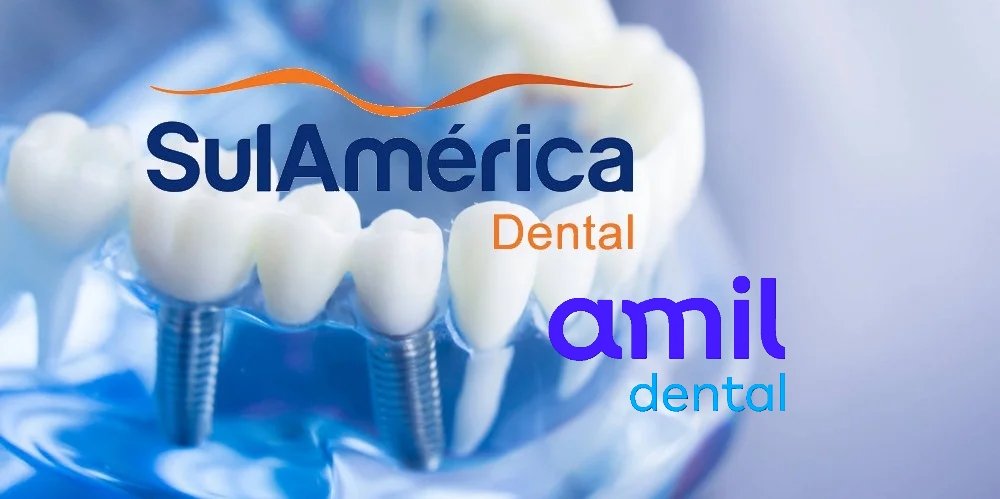 Diferenças-Amil-Dental-P7500-SulAmérica-Odonto-Premium